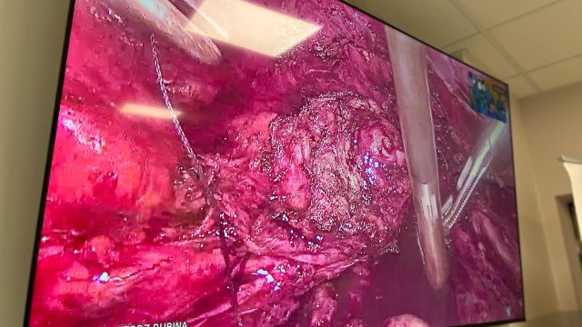 ENDOFORUM - Opolskie Centrum Onkologii